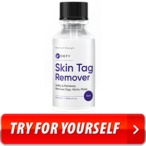 Defy Skin Tag Remover